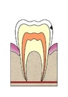 Images dental cavity 2