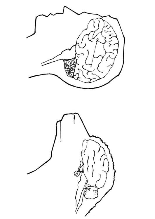 brains of human and sheep