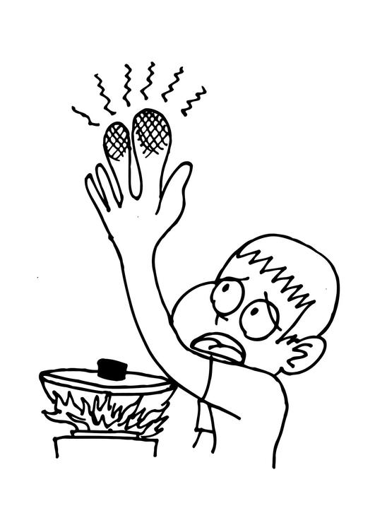 burn injury clipart