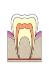 Image dental cavity 1