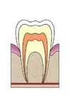 Image dental cavity 1
