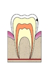 Image dental cavity 2