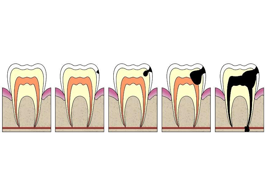 Image dental cavity