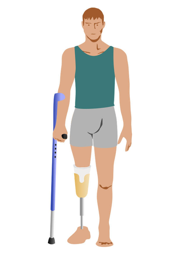 disabled Image disabled