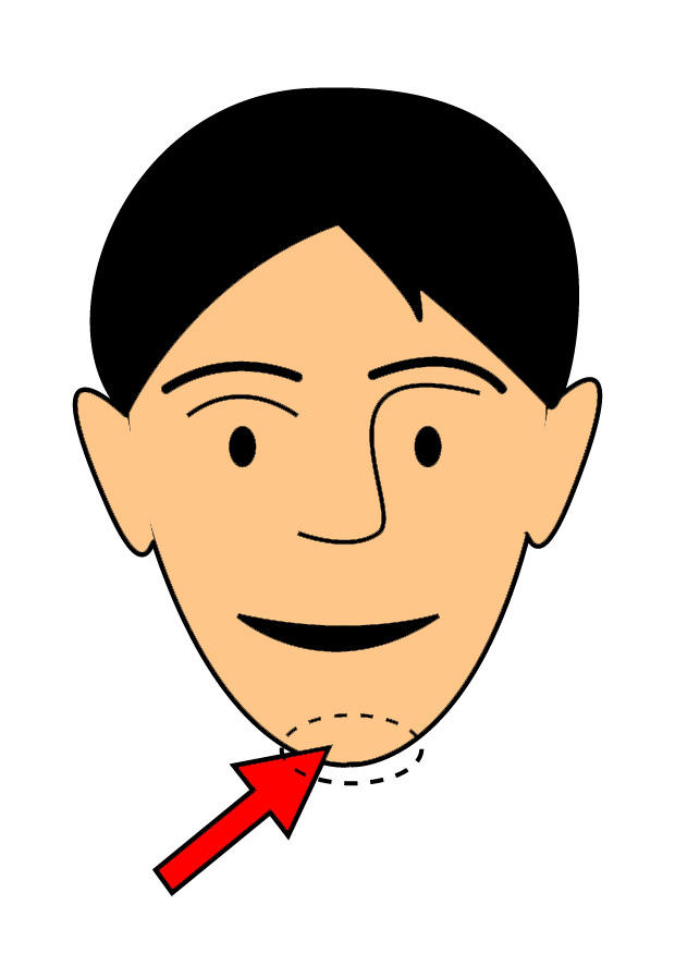 chin Image chin