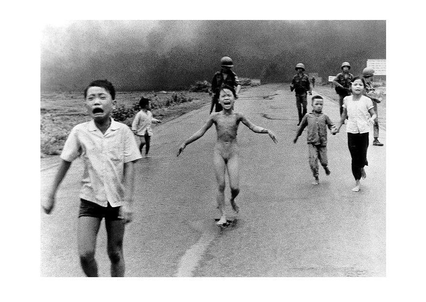 Photo children after napalm attack